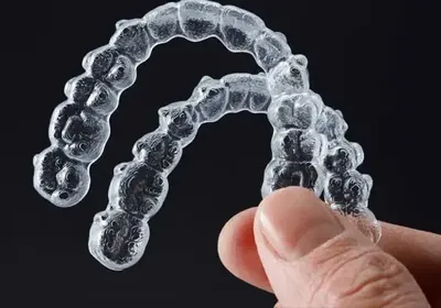 Orthodontic braces and aligners treatment at Blossom Dental Clinic Ahmedabad