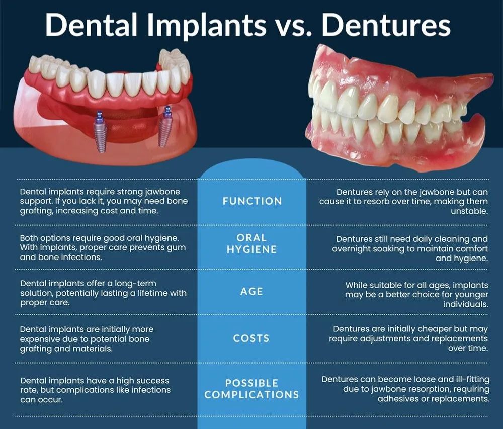 Dental Implants versus Dentures