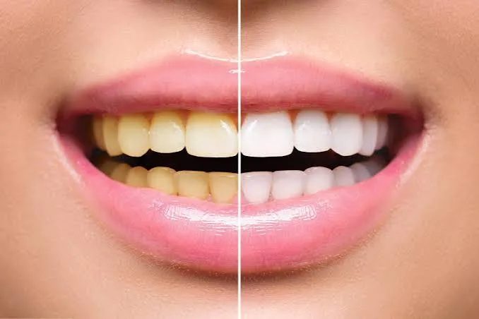 Step 4: Results