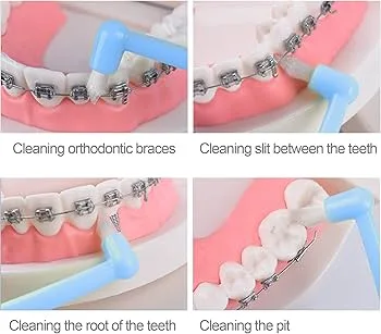 flossing technique