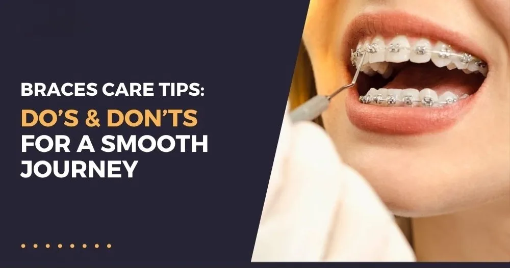 Braces Care Guide: Do’s and Don’ts for a Smooth Orthodontic Journey