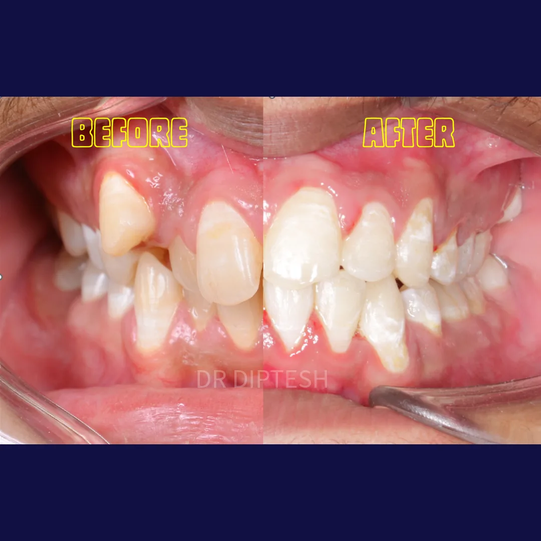 Smile transformation