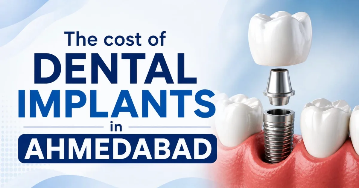 Dental Implant Cost in Ahmedabad 2026: Complete Price Guide for Tooth Replacement